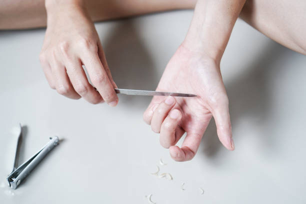 fixing damaged nails