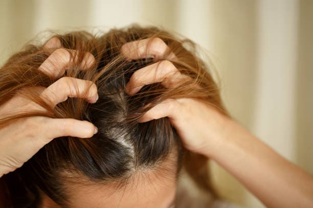 Why my scalp is itching